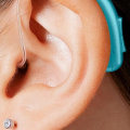 When Should a Hearing Aid Be Fitted for a Pediatric Patient with Congenital Hearing Loss?